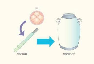 胚凍結法（ガラス化保存法）