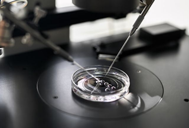 体外受精のイメージ写真